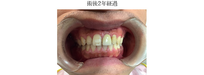 治療後