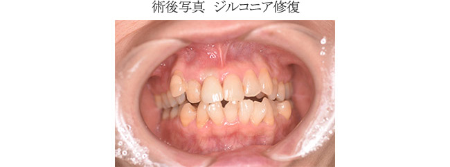 治療後